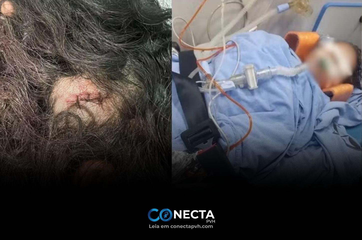 Homem é preso após após agredir gravemente cabeça do enteado de 3 anos em Buritis